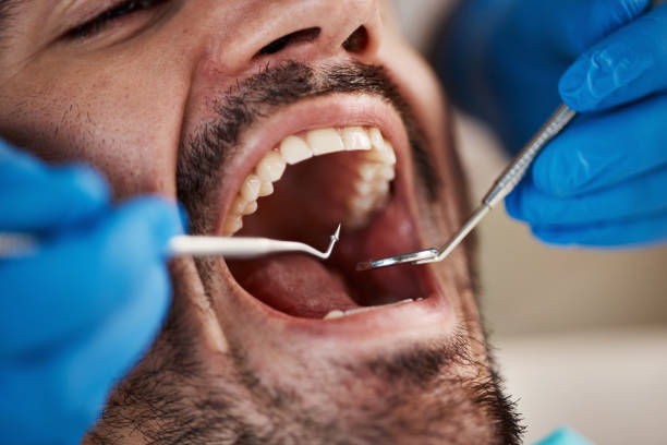 Best Broken Tooth Emergency  in Pflugerville, TX